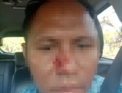 Polisi Selidiki Dugaan Penganiayaan Sopir Bluebird di KEK Mandalika, Korban Alami Luka dan Trauma